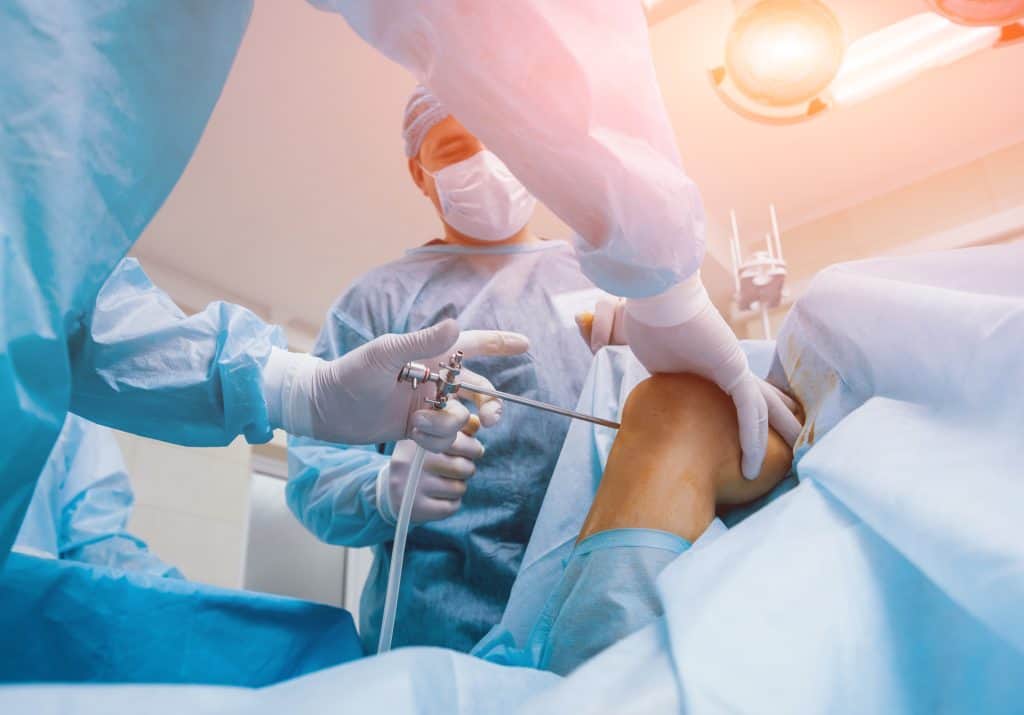 Arthroscopic Surgeries in Egypt