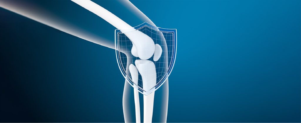 متى تحتاج إلى عملية تغيير مفصل الركبة